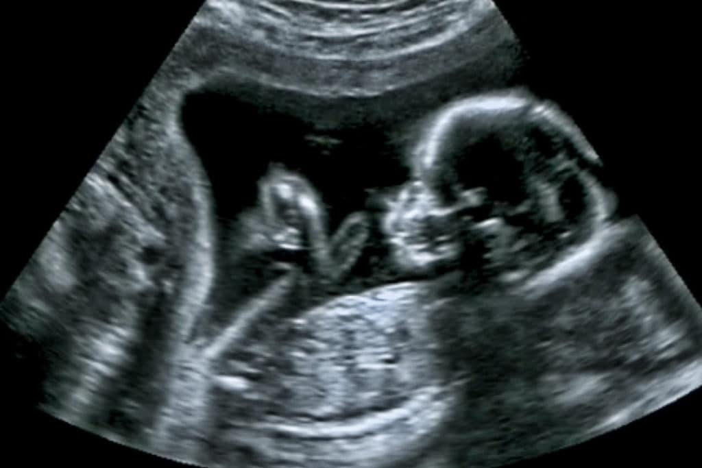 A ultrasound image of an unborn child symbolizes the solidarity with future generations that is a pillar of the Church's approach to the physical environment