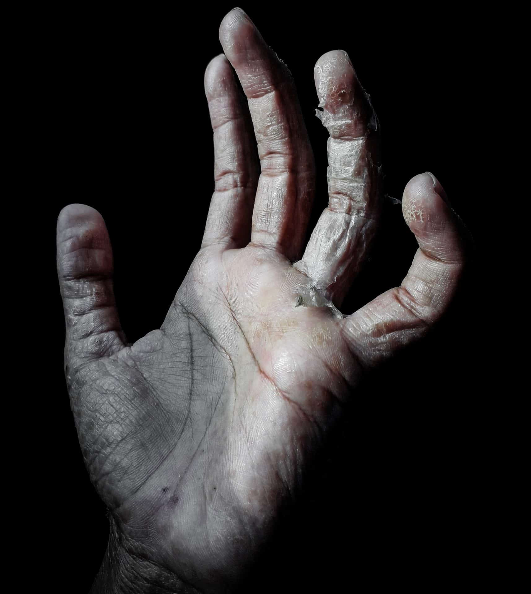 A blistered hand is held up against a black background, symbolizing the solidarity that will be required to face the environment crisis